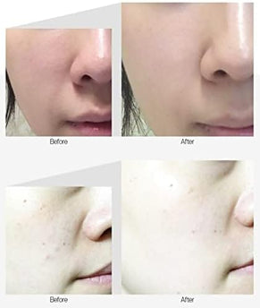 MEDI-PEEL Peptide Tox-Bor Ampoule 30ml