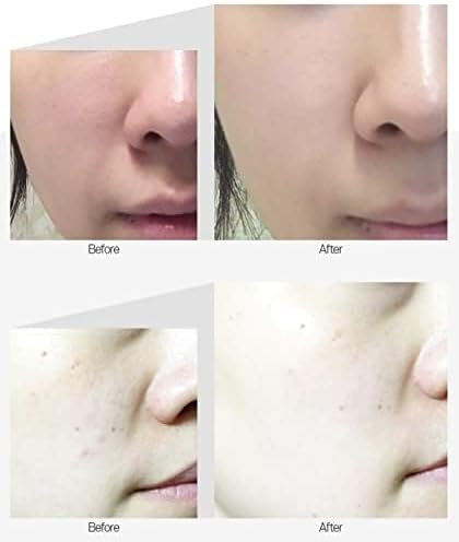 MEDI-PEEL Peptide Tox-Bor Ampoule 30ml