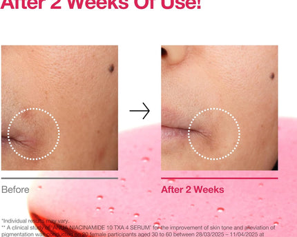 Anua Niacinamide 10% + TXA 4% Serum 30ml