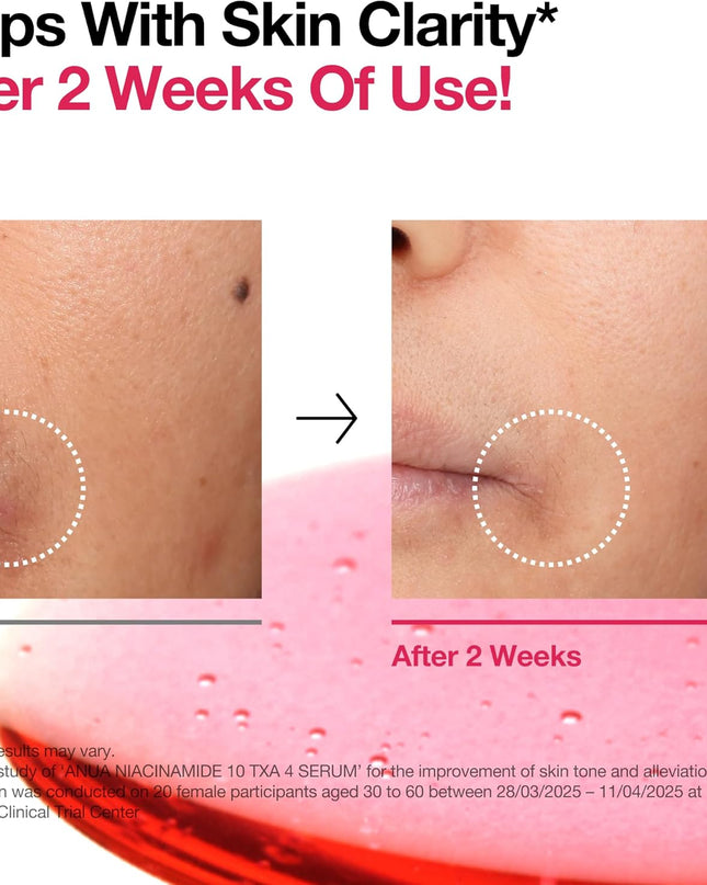 Anua Niacinamide 10% + TXA 4% Serum 30ml